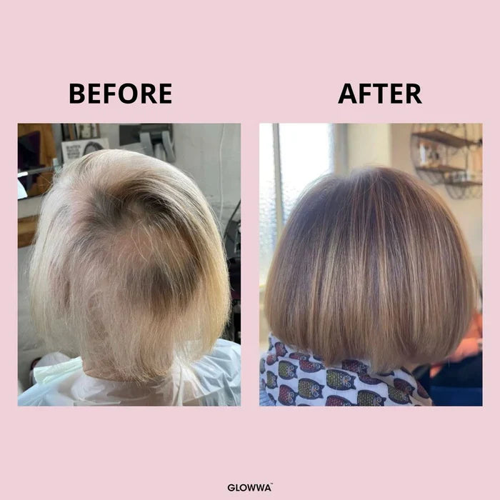 Hair Loss