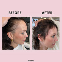 Before and after comparison photos of a woman's hairline and scalp, showing increased hair density or coverage. The image has a light pink background with the words 'BEFORE' and 'AFTER' above the two side-by-side photos, and the brand name 'GLOWWA' at the bottom.