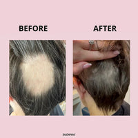 Before and after comparison of hair treatment on a person's head with 'GLOWWA' branding.