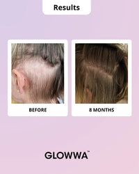 Glowwa Hair Food Menopause Hair Vitamins - 1 Month Supply