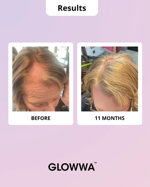 Glowwa Hair Food Menopause Hair Vitamins - 1 Month Supply