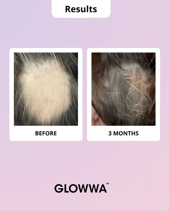 Glowwa Hair Food Menopause Hair Vitamins - 1 Month Supply